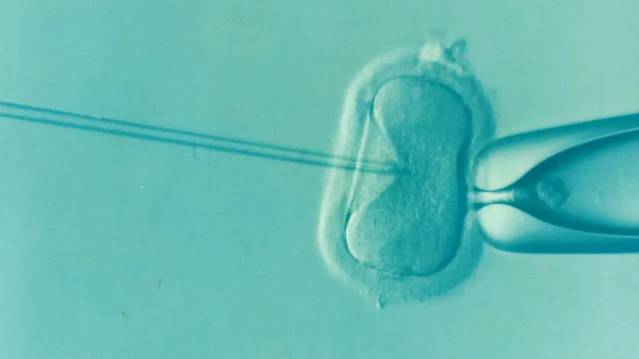 The In vitro fertilisation card