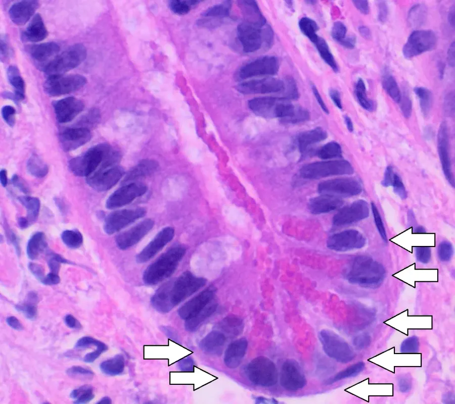 La carte Cellule de Paneth