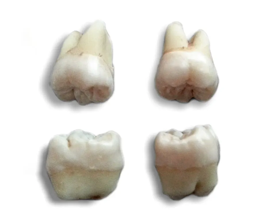 The Wisdom tooth card