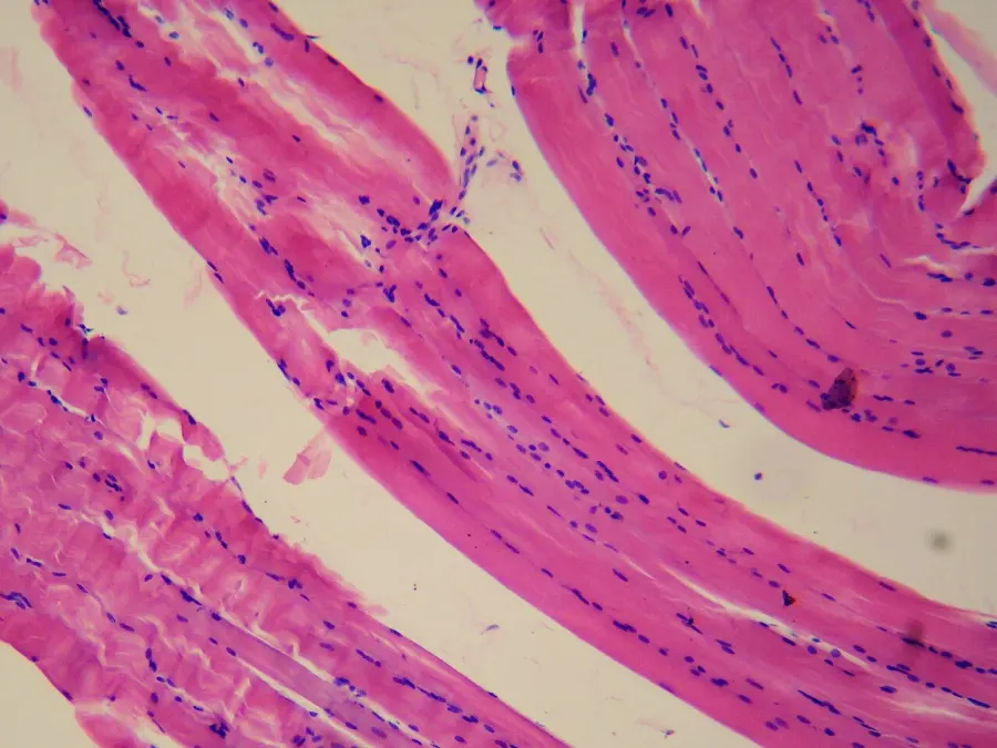 The Smooth muscle card