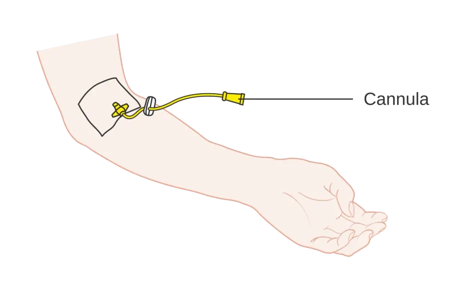The Cannula card