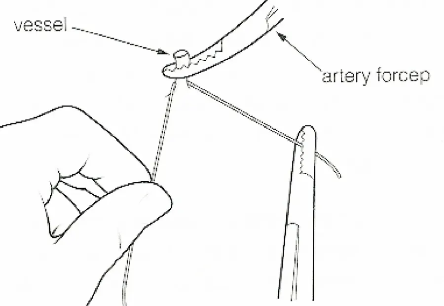 La carte Ligature