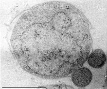 La carte Nanoarchaeum equitans
