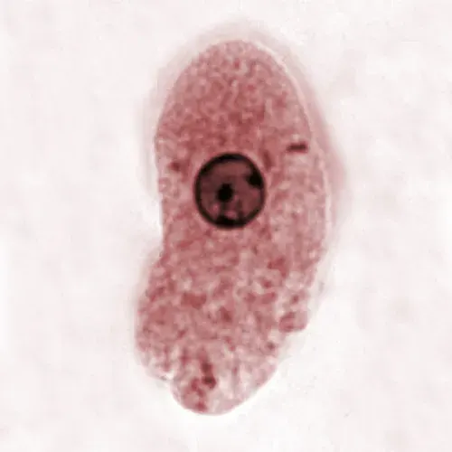 The Mitosome card