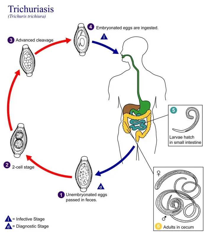 La carte Trichocéphalose
