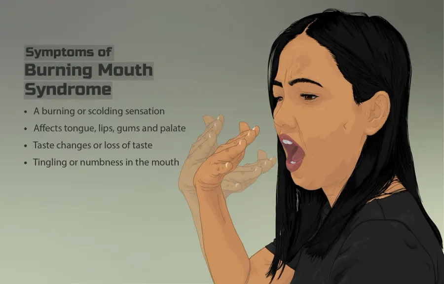 The Burning mouth syndrome card