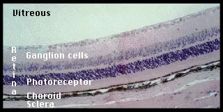 The Retinal pigment epithelium card