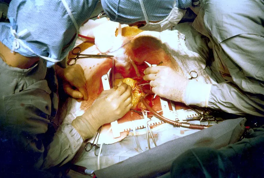 The Cardiac surgery card