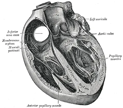 La carte Septum interventriculaire