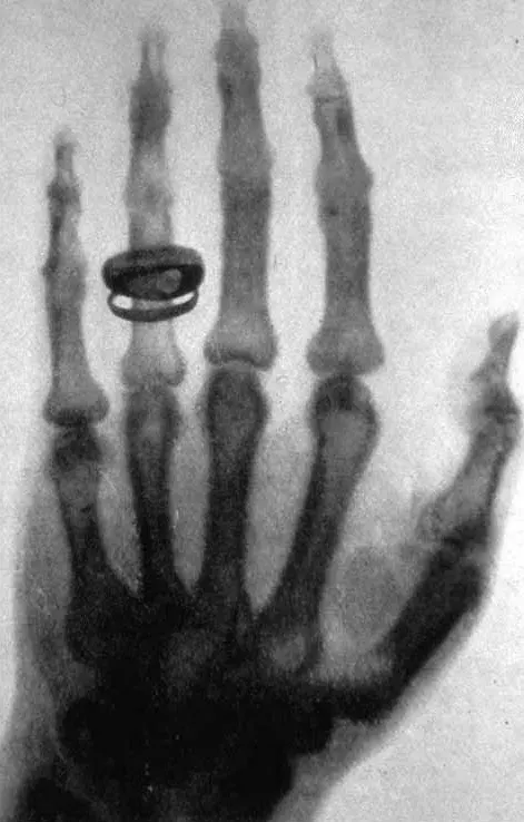 The Radiography card