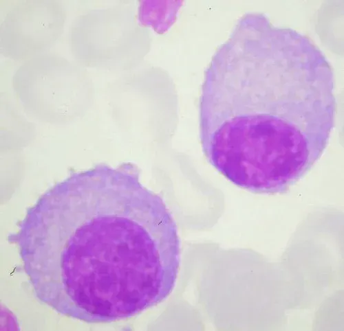 La carte Plasmocyte