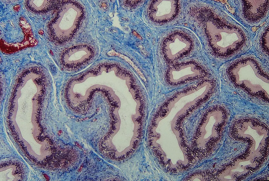The Connective tissue card