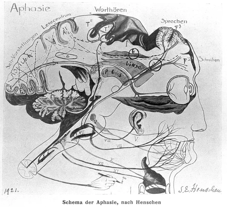 The Aphasia card