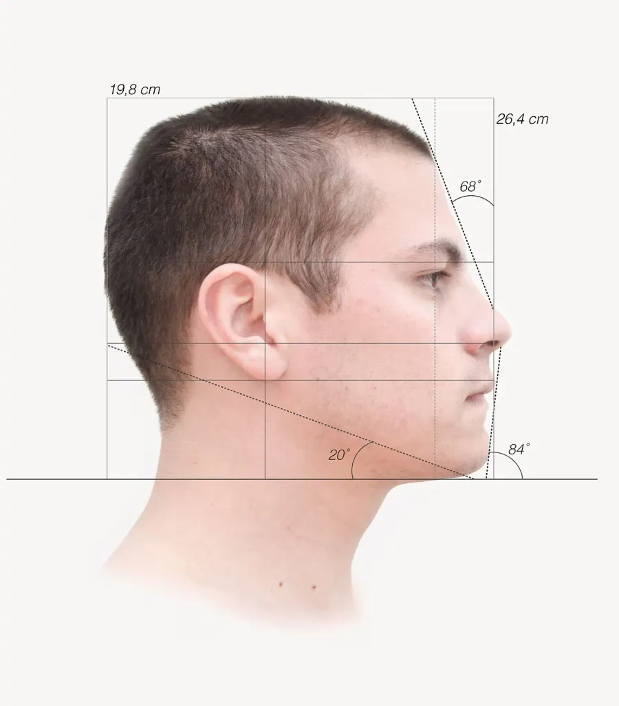 La carte Angle facial