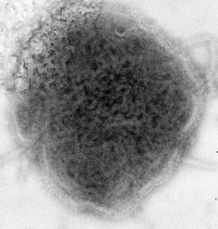 The Mumps virus card
