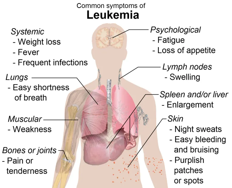 The Leukemia card