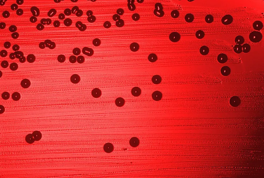 La carte Haemophilus
