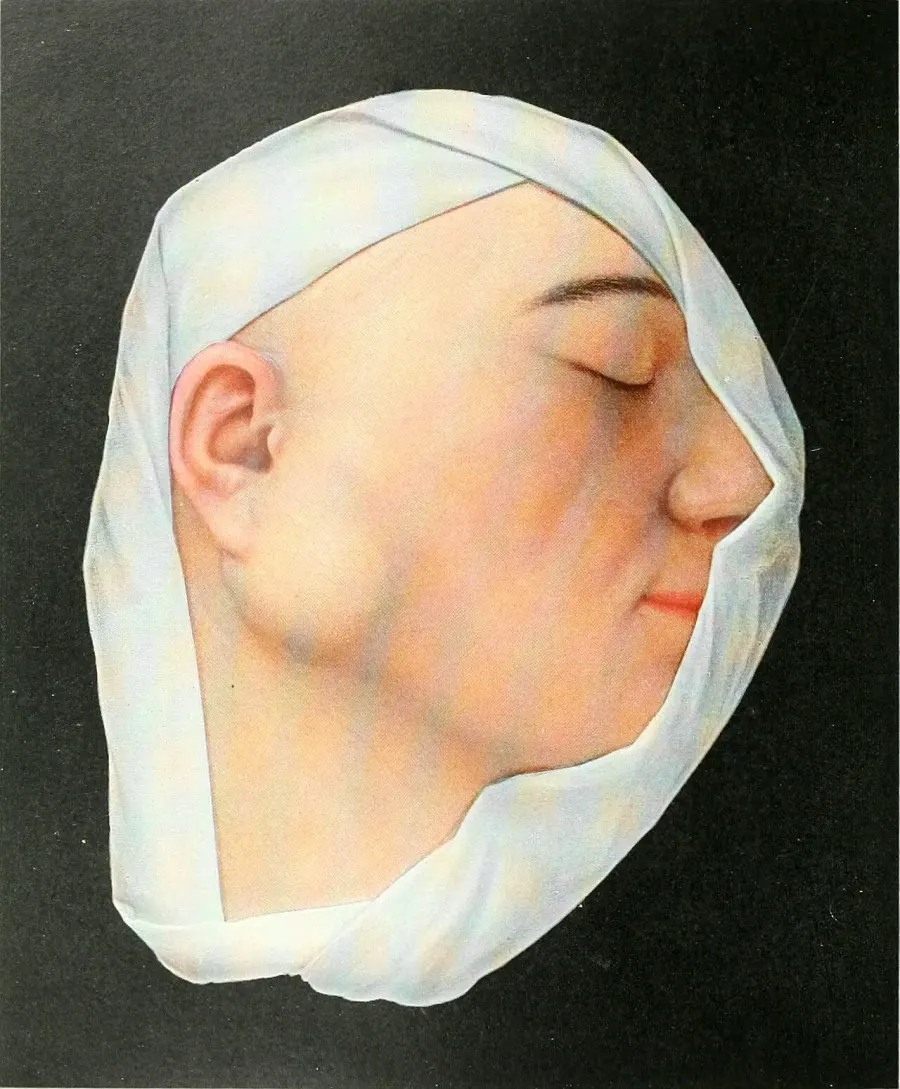 The Salivary gland tumour card