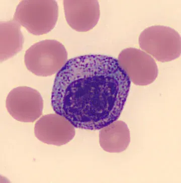 The Myelocyte card