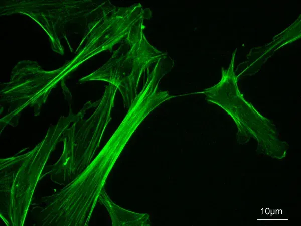 The Actin filament card
