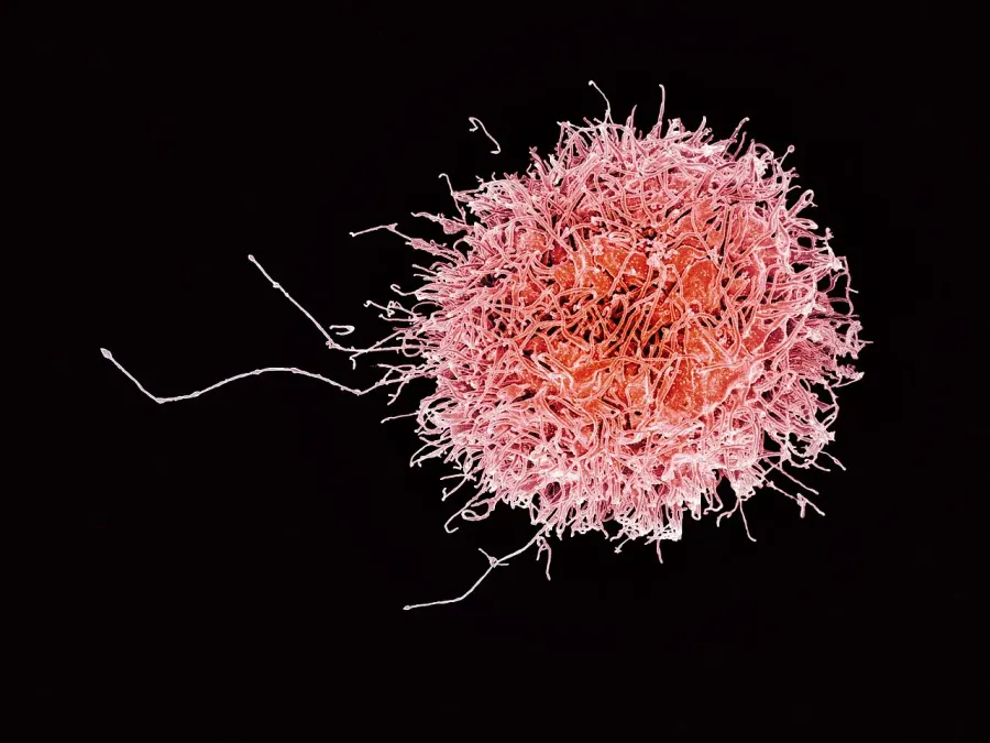La carte Lymphocyte NK