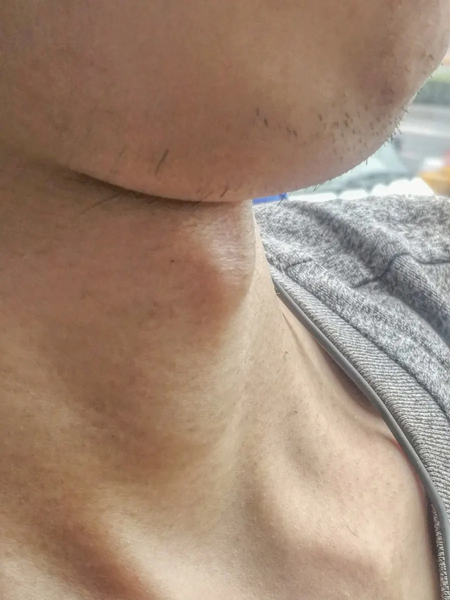 The Adam's apple card
