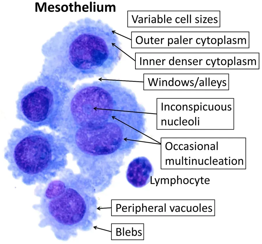 The Mesothelium card