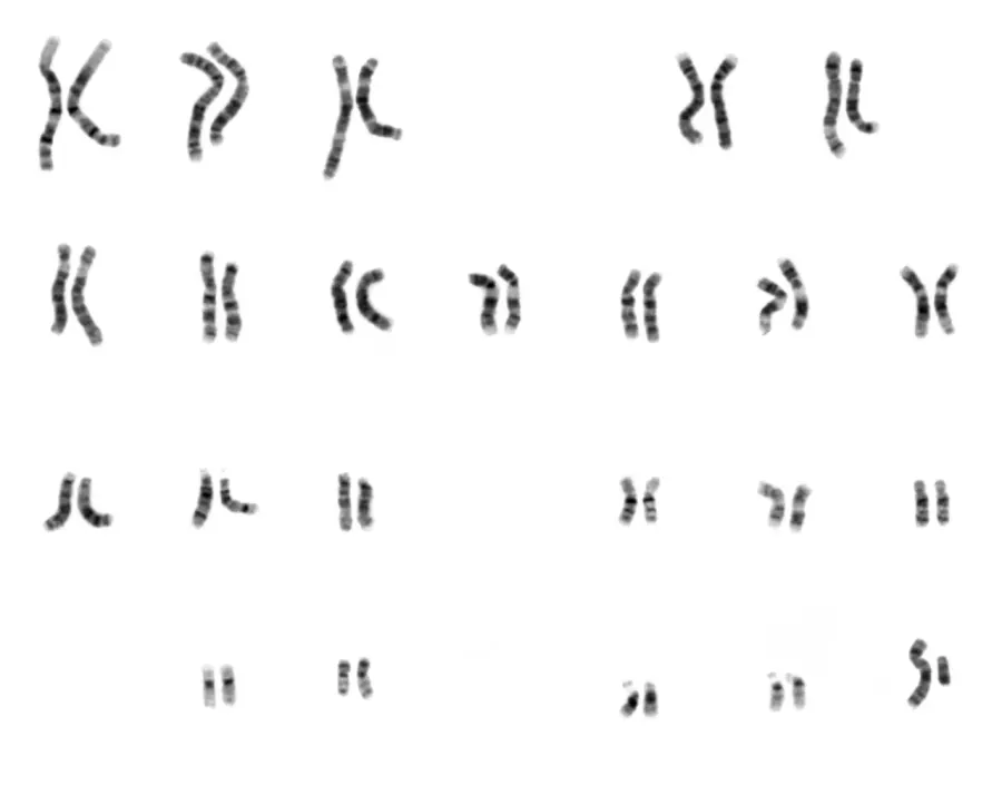 La carte Chromosome