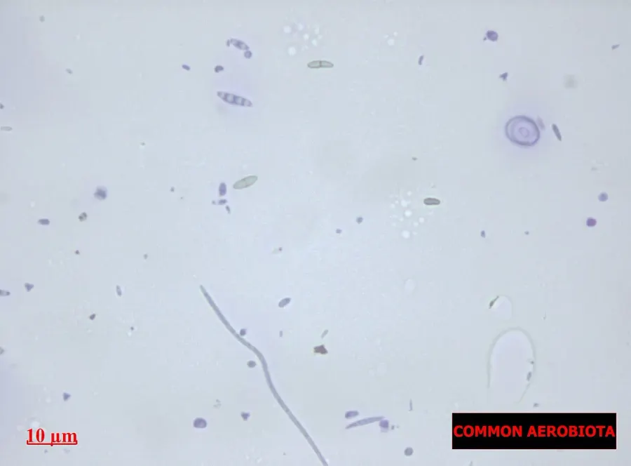 La carte Aérobiologie