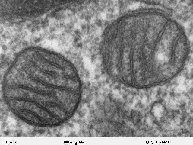 La carte Mitochondrie