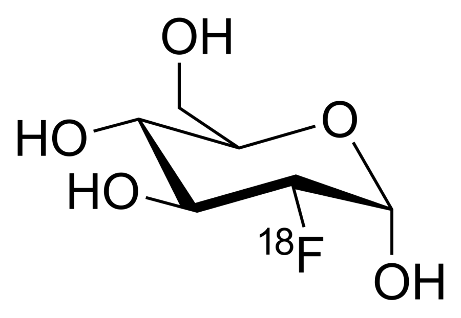 The Fluorodeoxyglucose card