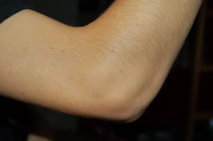 The Elbow card