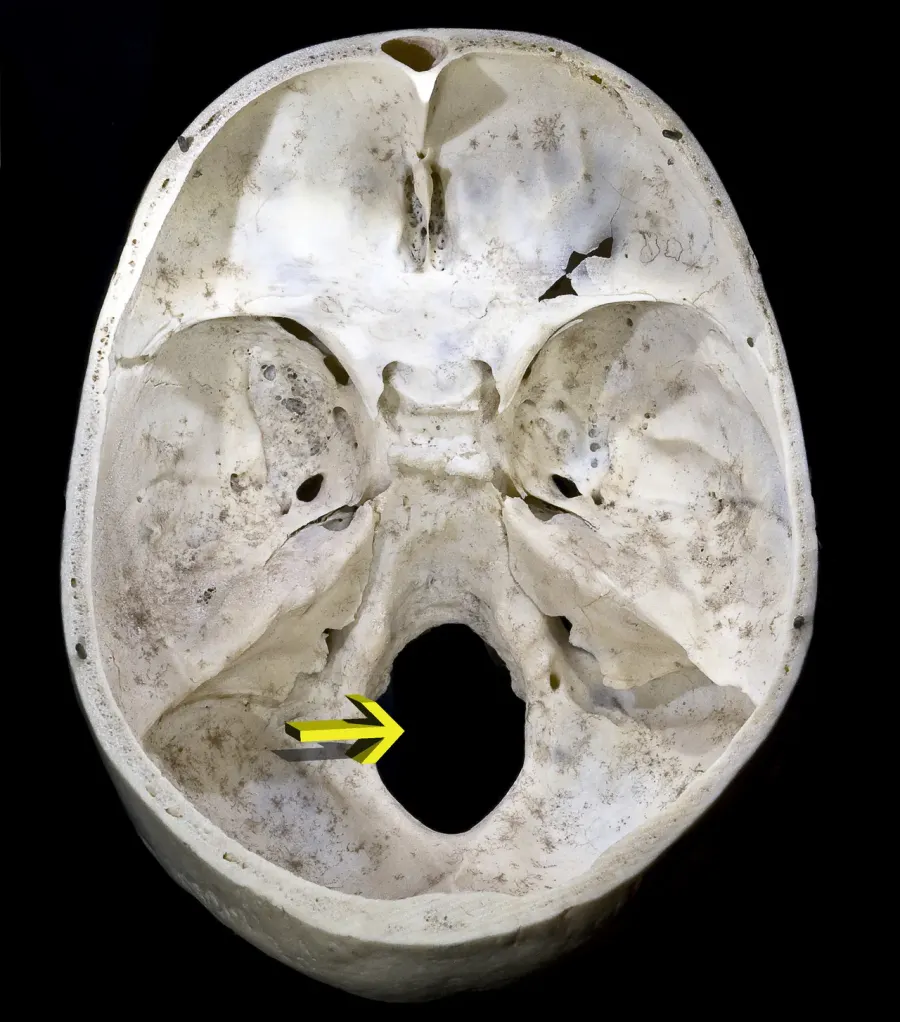 The Foramen magnum card