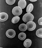The Hemoglobin card
