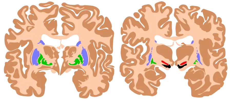 The Basal ganglia card
