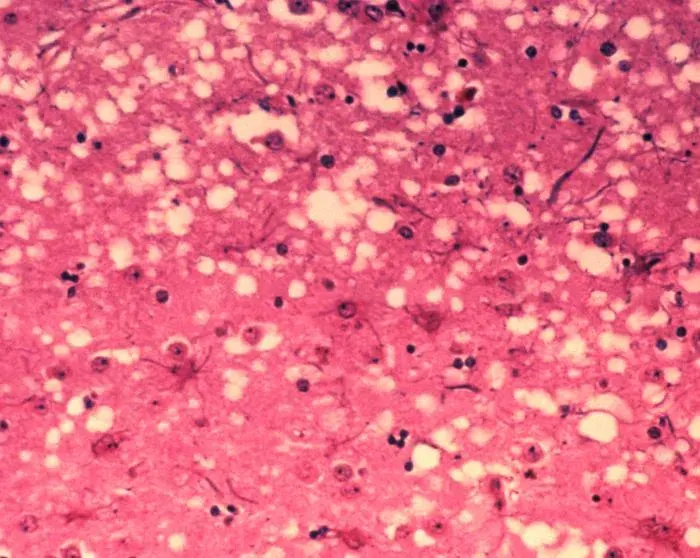 La carte Prion