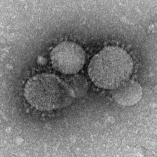 La carte Coronavirus du syndrome respiratoire du Moyen-Orient