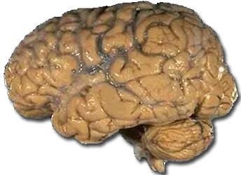 La carte Cerveau humain