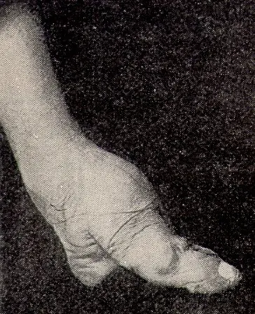 The Foot binding card