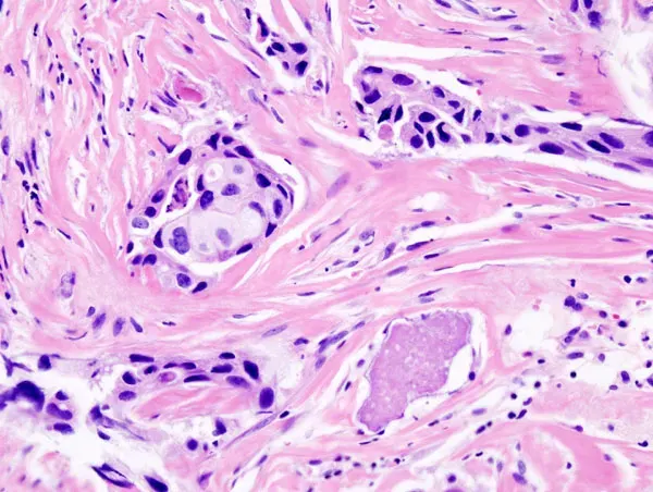 La carte Biologie médicale