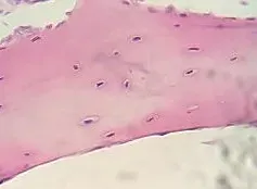 The Cartilage card