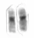 The Chromosome 19 card