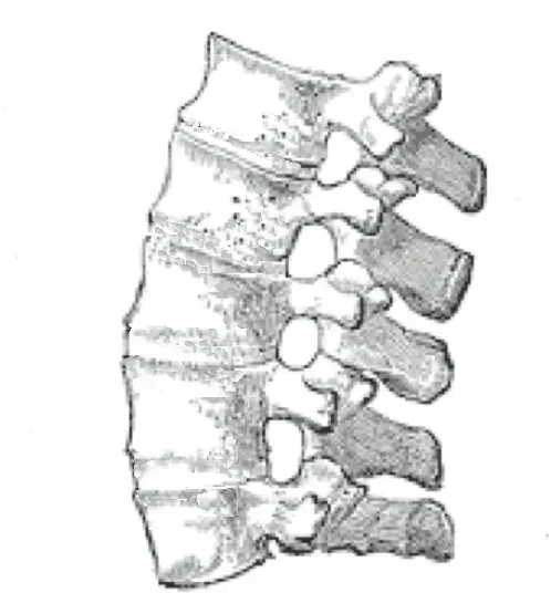 The Ankylosing spondylitis card