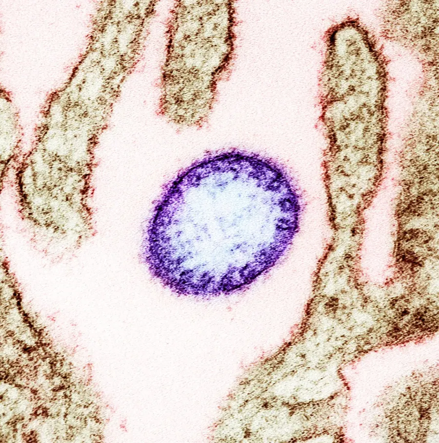 The Nipah virus infection card