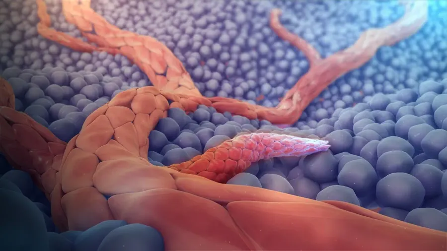 The Angiogenesis card