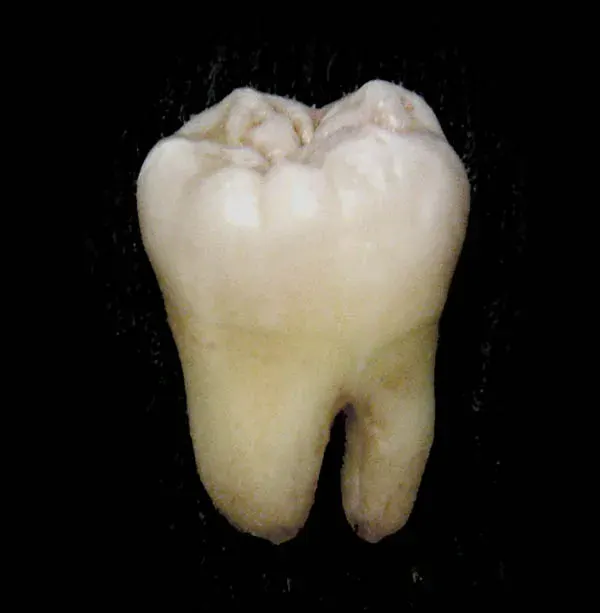 The Tooth card