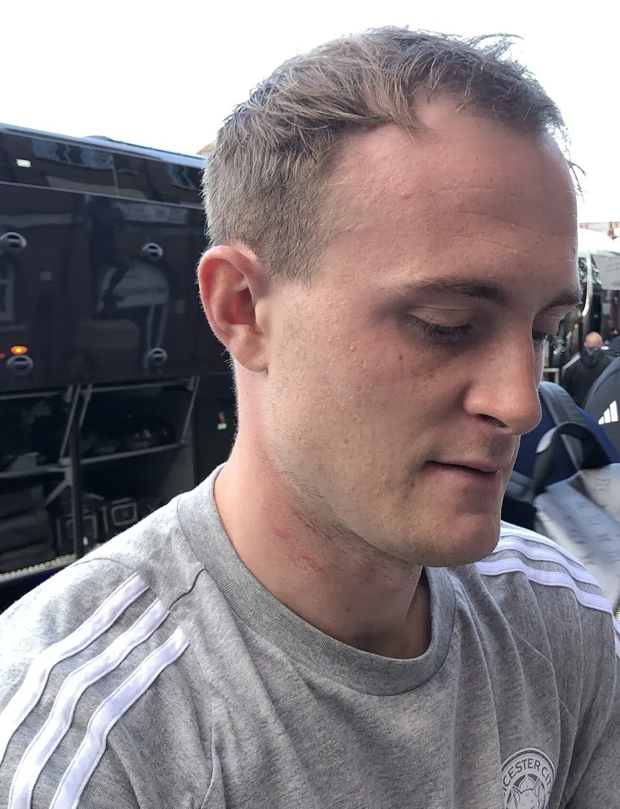 The Oliver Skipp card