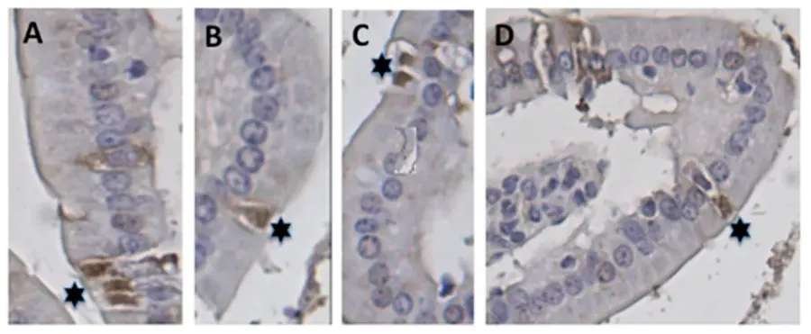 The Enterochromaffin cell card