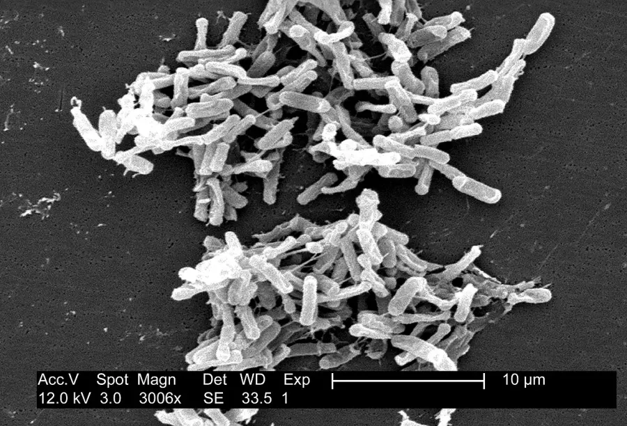 La carte Colite pseudomembraneuse