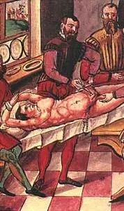 La carte Castration